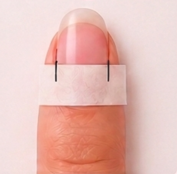 Étape 2
